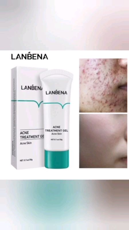 #LANBENA#gel trị mụn#mụn bị tắc#mụn viêm#mụn đầu đen#chăm sóc da mụn#TeaTreeOil#skincare#da mặt sáng#giảm dầu trên mặt#ShopeeAffiliate#đánh giá làm đẹp