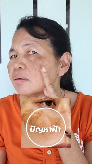 #มาส์กหน้าโรสโกล์ด #rosegoldmask #มาส์กกุหลาบทองคำ #ลดฝ้า #ลดกระ #จุดด่างดำ #ผิวใส #ผิวดารา #swp #swpthailand