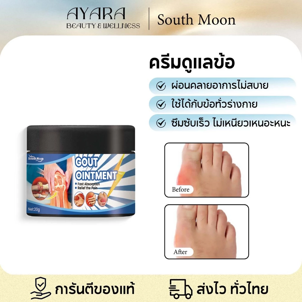 【ซื้อ 1 แถม 1】South Moon ครีมบรรเทากรดยูริก 20g ครีมรักษาโรคเกาต์ ครีมบำรุงข้อ ลดบวมระบายปวด บรรเทาอาการปวดข้ออักเสบครีม